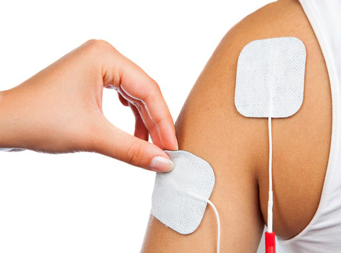 Transcutaneous Electrical Nerve Stimulation (TENS) Image