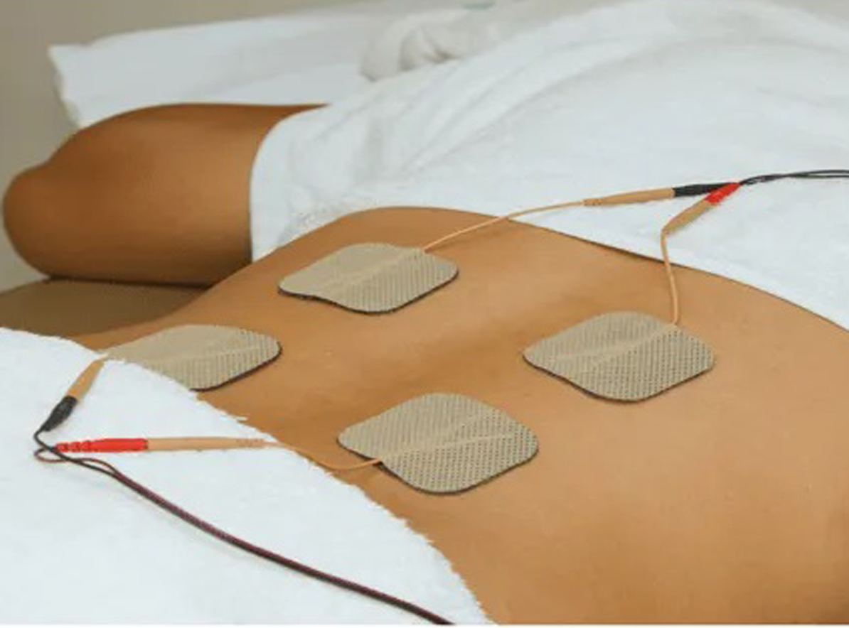 Transcutaneous Electrical Nerve Stimulation (TENS) Image